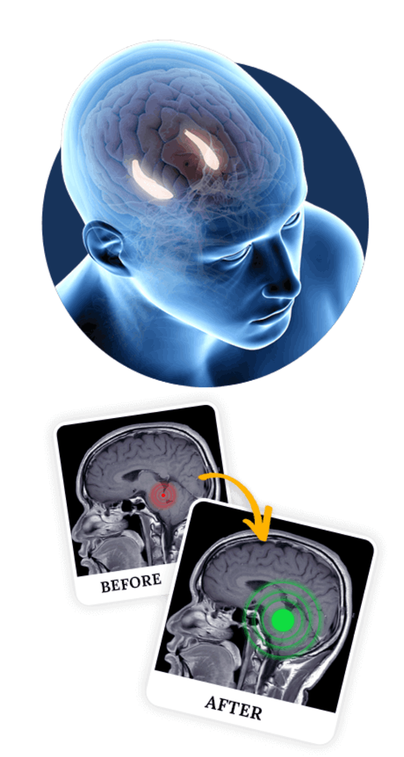 The-Billionaire-Brain-Wave-official-site